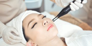Điều Trị Nám Hà Nội