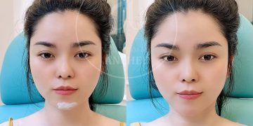 bống spa