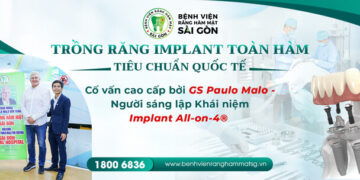 trồng răng implant giá bao nhiêu